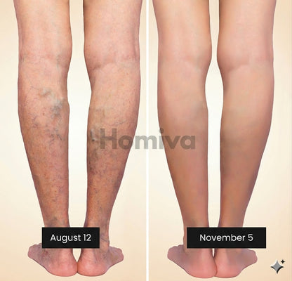 3D Anti-Cellulite Leggings HomivaRituals